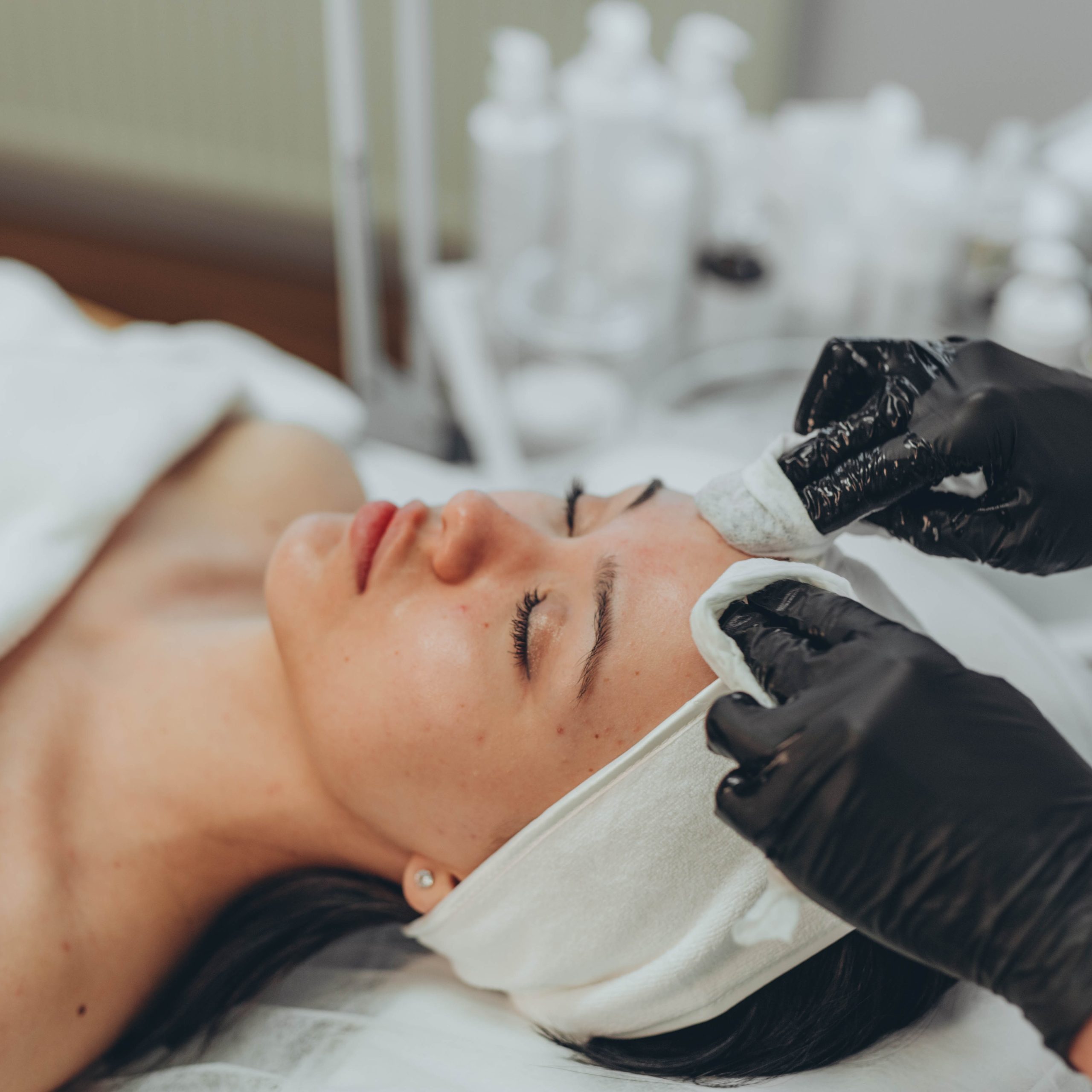 PEELING QUÍMICO PARA ESTETICISTAS – EAD