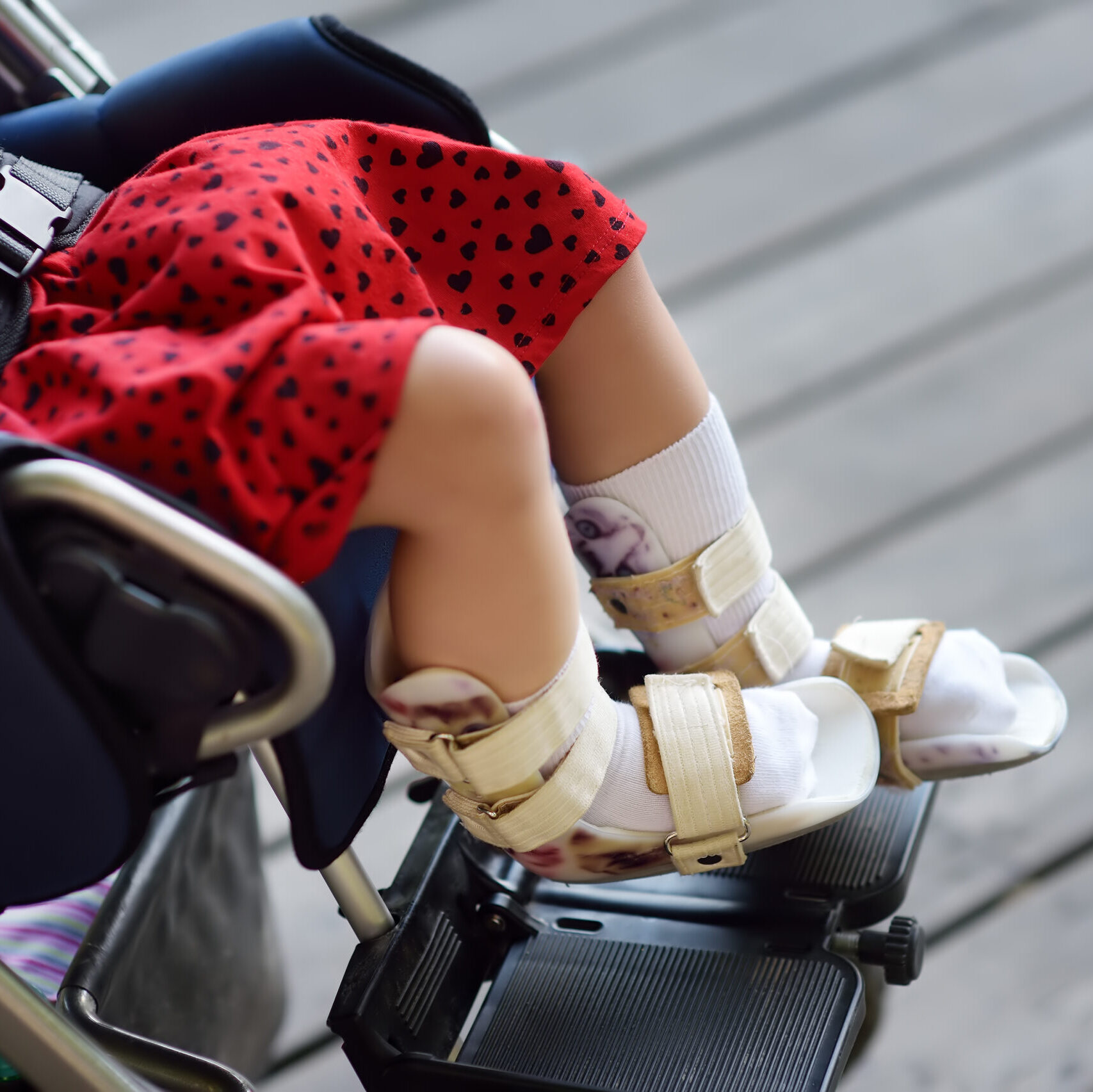 DISTÚRBIOS ORTOPÉDICOS EM PEDIATRIA E NEONATOLOGIA | ONLINE AO VIVO