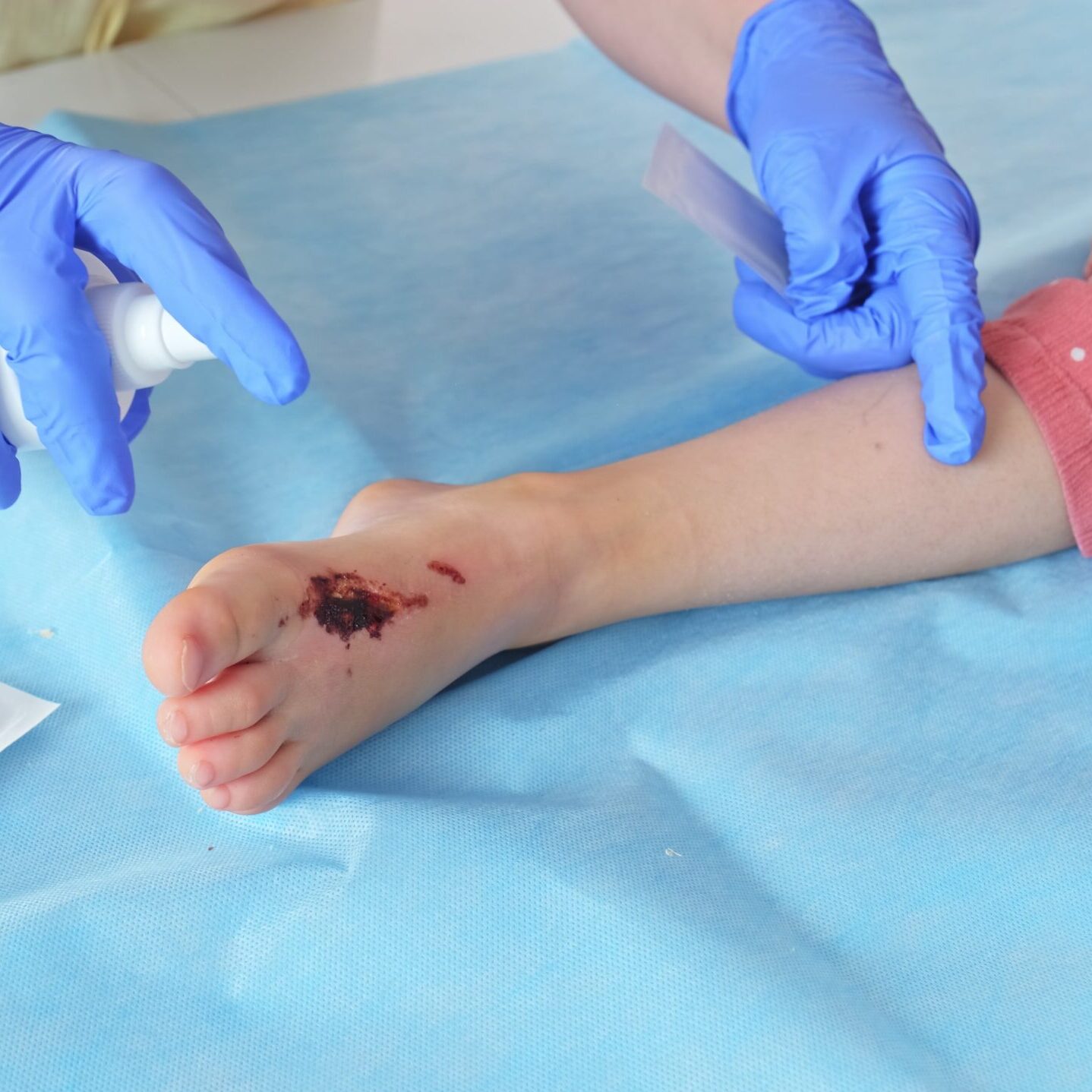 INOVAÇÕES NA ASSISTÊNCIA DO ENFERMEIRO À CRIANÇA COM LESÕES DE PELE | PRESENCIAL