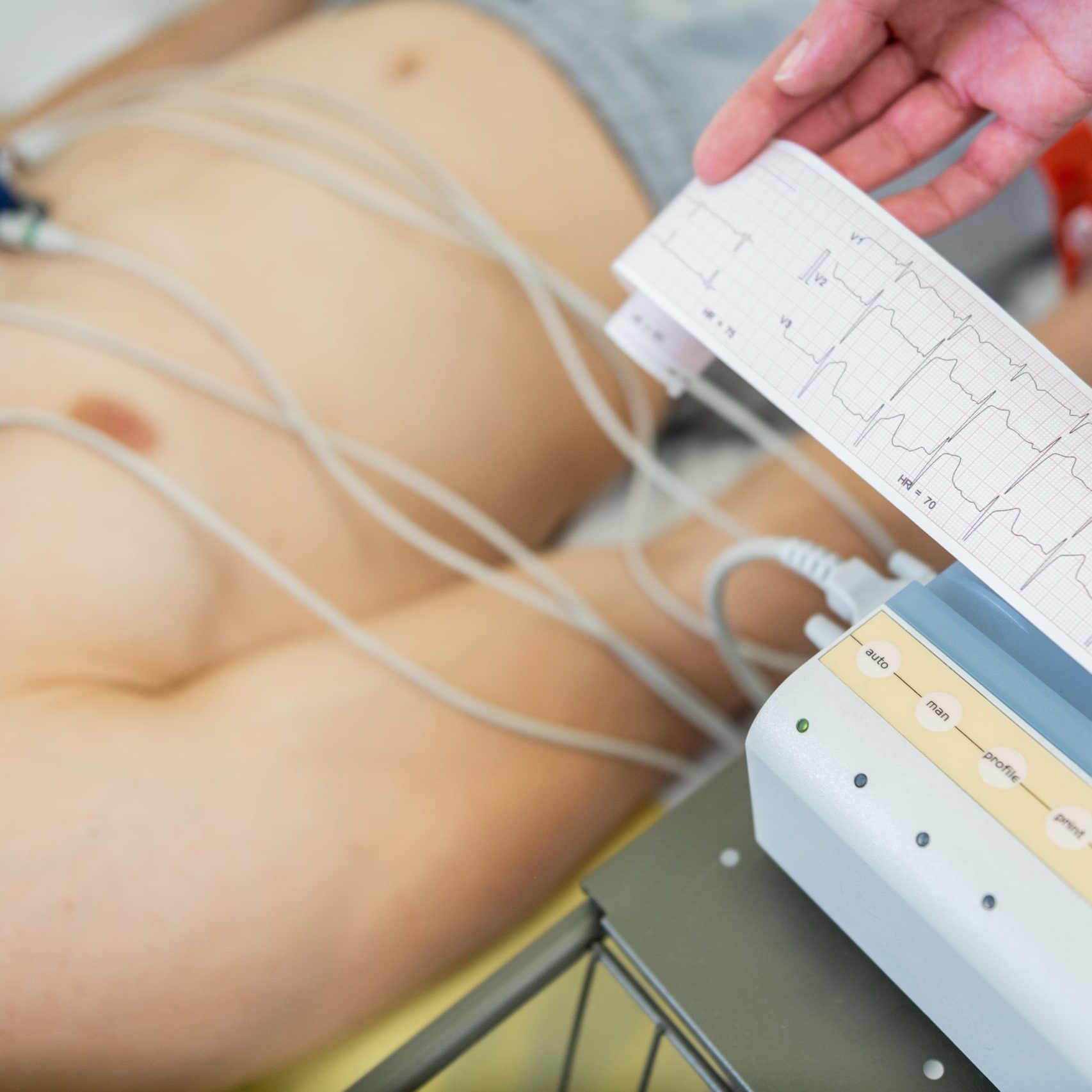 Interpretação de Eletrocardiograma e Condutas de Atendimento das Disritmias