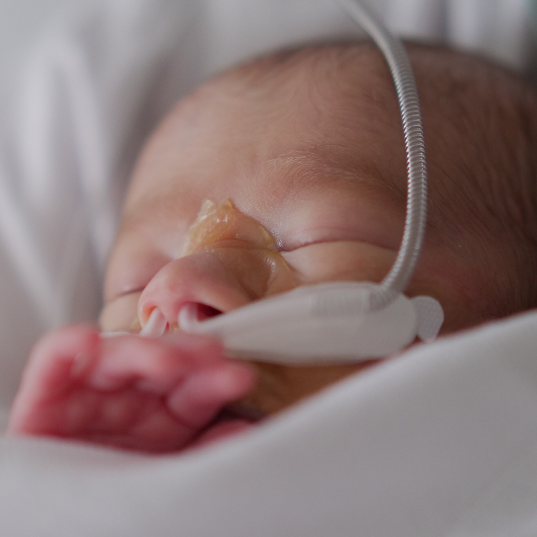 DISTÚRBIOS RESPIRATÓRIOS EM PEDIATRIA E CUIDADOS INTENSIVOS NEONATAIS – Presencial